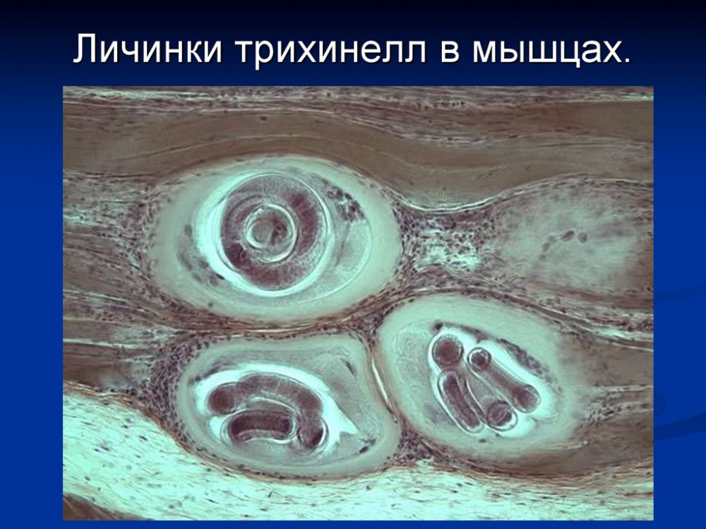 О снятии карантина по трихинеллезу диких животных на территории Немского района Кировской области
